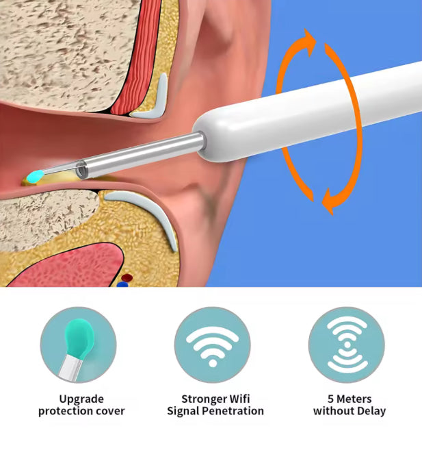Smart Earwax Cleaner